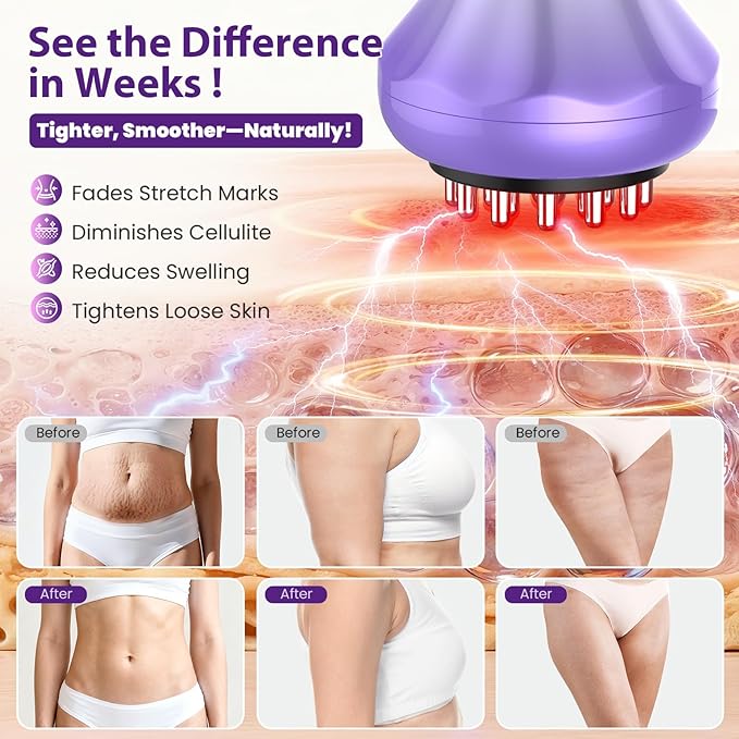 Lymphatic Drainage Massager Anti Cellulite Massage Tool For Thigh &amp Belly Stretch Marks &amp Cellulite Reduction Handheld Massage tools for Sciatica Nerve Legs Arms Hip Muscle Low Back Pai