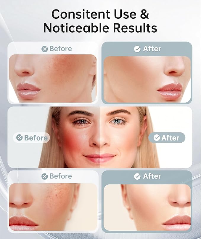 7 Color Light Therapy Facial Massager with Adjustable Vibration and Thermals for Wrinkles Double Chin Red Light Skin Care Tool with Base Black
