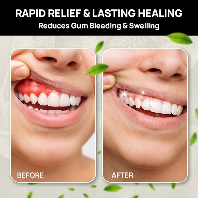 The Goodbye Company Healthy Gum Rinse – Handcrafted Natural Mouthwash for Bleeding Gums Receding Gums &amp Fresh Breath | Organic Herbal Blend with Essential Oils | Small Batch Made in Florida