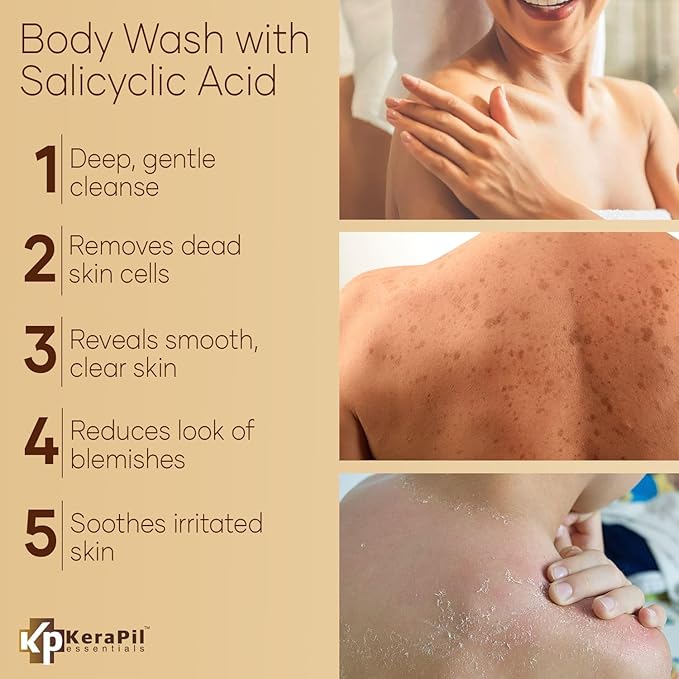 Exfoliating Body Wash with Salicylic Acid - No Dry Out Gentle Exfoliates Rough and Bumpy Skin Body Acne Wash BHA &amp AHA - Coconut and Vanilla Salicylic Acid Body Wash - (16 fl oz x 2)