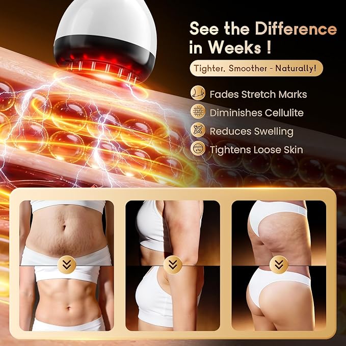 Lymphatic Drainage Massager &amp Anti Cellulite Massage Tool Helps Reduce Stretch Marks &amp Cellulite for Legs Arms &amp Belly Body Sculpting Machine with Microcurrent &amp Red-Light &amp He