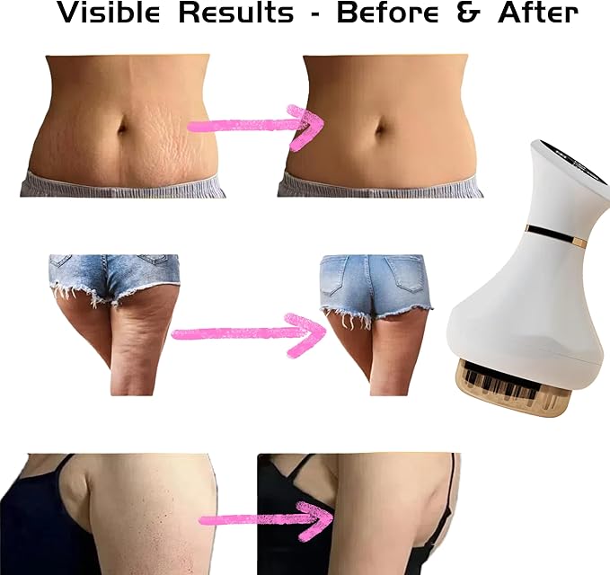 Body Sculpting Machine Lymphatic Drainage Massager &amp Anti Cellulite Massage Tool Helps Reduce Stretch Marks &amp Cellulite Pain Relief Devices for Sciatica Nerve Legs Arms Hip Muscle &amp
