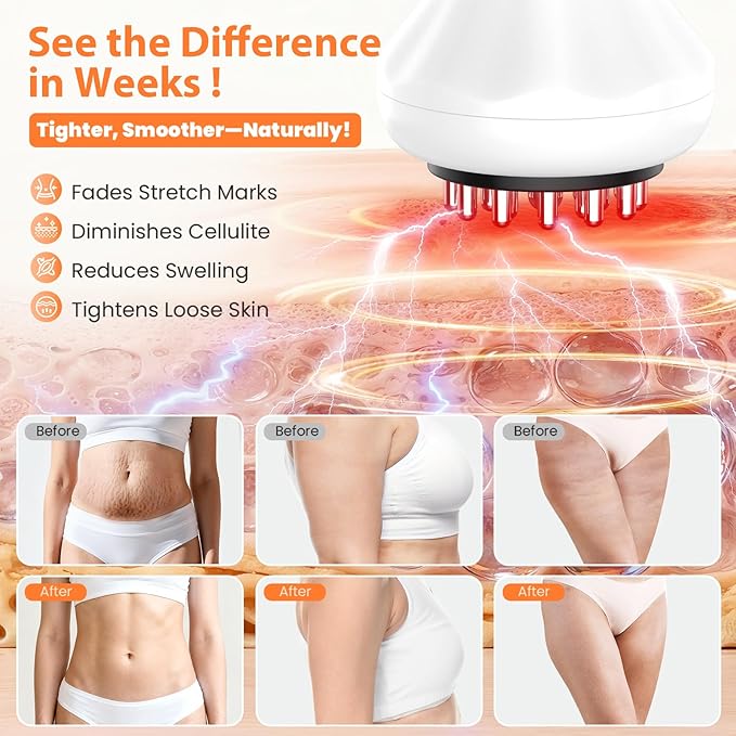 Lymphatic Drainage Massager Anti-Cellulite Massager For Body Cellulite and Thigh &amp Belly Stretch Marks Reduction Handheld Massage tools for lymphedema &amp lipedema Sciatica Nerve pain relief
