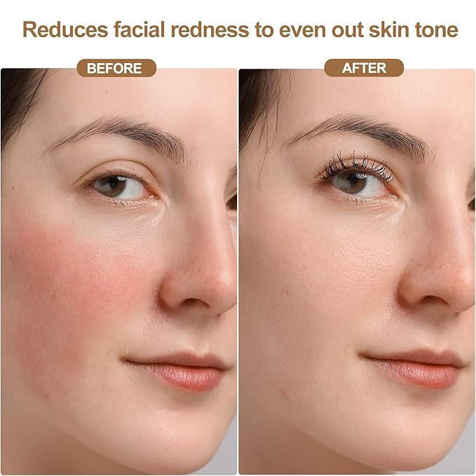 Red Light Therapy Mask for Face Wireless Led Face Mask Light Therapy with 850nm Near-Infrared 4 Modes Rechargeable Led Facial Skincare Device