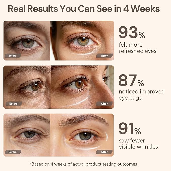 Red Light Therapy for Eyes Under Eye Red Light Eye Mask for Fine Lines Eye Bags 3 Modes Face Mask Device Infrared Light Therapy for Dark Circles Visual Wellness Eye Fatigue Jet Lag