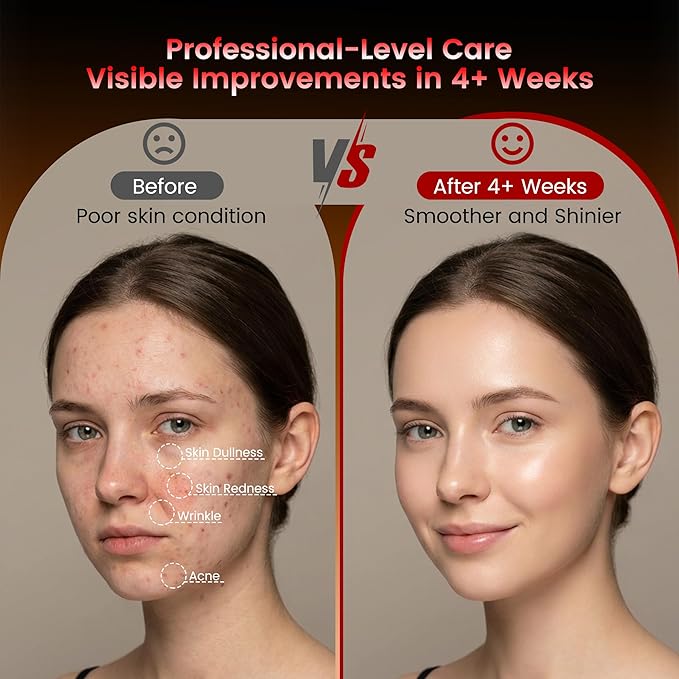 Wireless Red Light Therapy Mask for Face with 104 LEDs &amp 4 Modes – Anti-Wrinkle &amp Acne Treatment for Full Face Chin &amp Jawline Portable for Home &amp Travel Use Ideal Skincare Gifts for