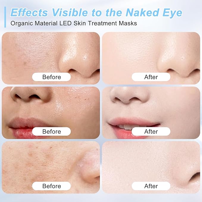 Red Light Therapy for face