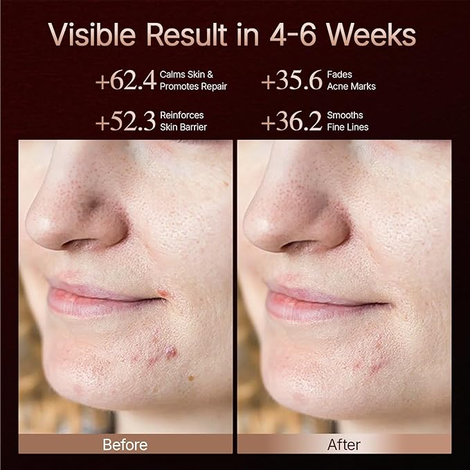 4D Red Light Therapy for Mask 311 LEDs 850nm Infrared Long Light Waves Red Light Therapy for Face Skin Improvement No Light Leakage for 3000mAh Rechargeable Remote Light Khaki