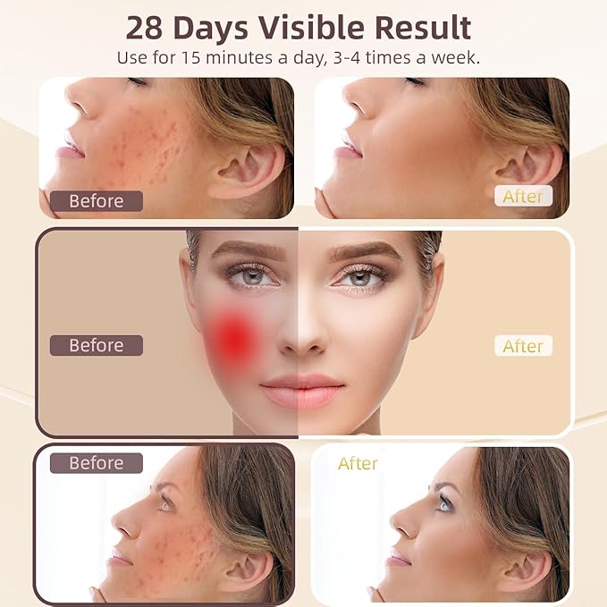 Red Light Therapy Facial Massager &amp Sculpting Device Portable 7-Color LED Skin Care Tool 490nm 525nm 630nm for Face and Neck Reducing Double Chin for Women and Man