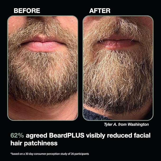 ZEUS BeardPLUS Beard Shampoo &amp Conditioner Set for Men Hair Growth Treatment for Hydration Softness &amp Thickness with Biotin &amp Caffeine (Made in USA) Combo Set