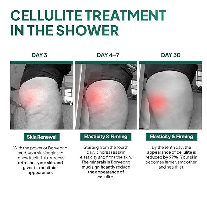 Anti Cellulite Mud Scrub Body Wash Reduces Cellulite Gentle Exfoliating Improves Skin Texture Provides a Smoother Look 5.07 Fl Oz (6)