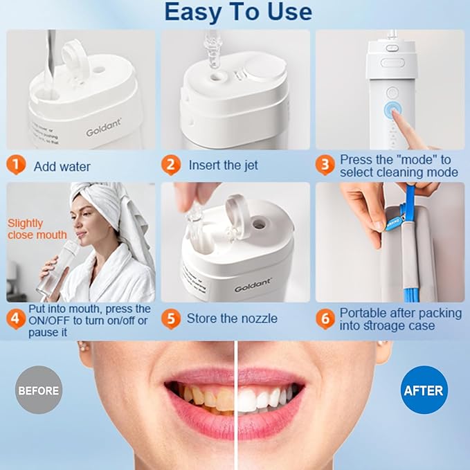 2026 New Portable Water Flosser for Teeth 4 Modes &amp 4 Intensity Levels Mini Small Design with Exquisite Travel Case Removable Tank IPX7 Waterproof Cordless Dental Oral Irrigator (Pink)