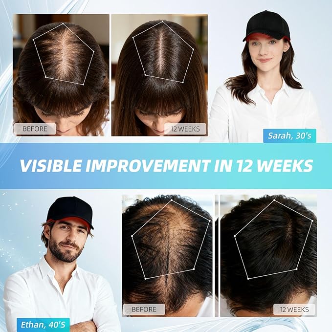 2026 Upgrade Wireless Laser Cap for Hair RegrowthRechargeable Red Light Therapy for Hair Growth