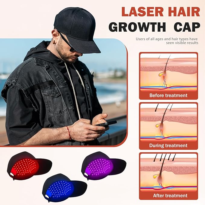 LLLT Laser Hair Growth Cap for Thinning Hair 650nm Red Light Therapy Hair Regrowth Treatment Full Scalp Coverage Hands-Free &amp Rechargeable Hair Loss Solution for Men &amp Women Black