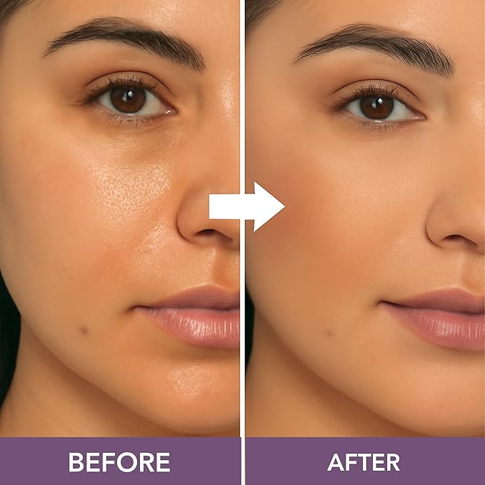 Dermaflage Mineral Powder Foundation - Full Coverage Talc-Free &amp Lasting Matte Finish - Natural Ingredients with Antioxidants - Safe for Sensitive Skin &amp Made in USA - Bronze Medium