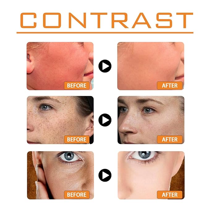 2PCS Sunscreen SPF 100 2025 Sunscreen For Body &amp Face SPF 100 Sun Screen For Sun Sensitive Skin Sunblock for Women