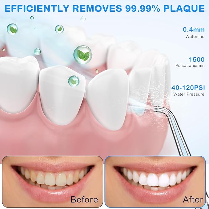 Water Dental Flosser for Teeth Cleaning and Flossing with Travel Size Case – Rechargeable Oral Irrigator KOOVON Portable Water Flosser for Adults IPX7 Waterproof 5 Jet Tips &amp 4 Modes Blue