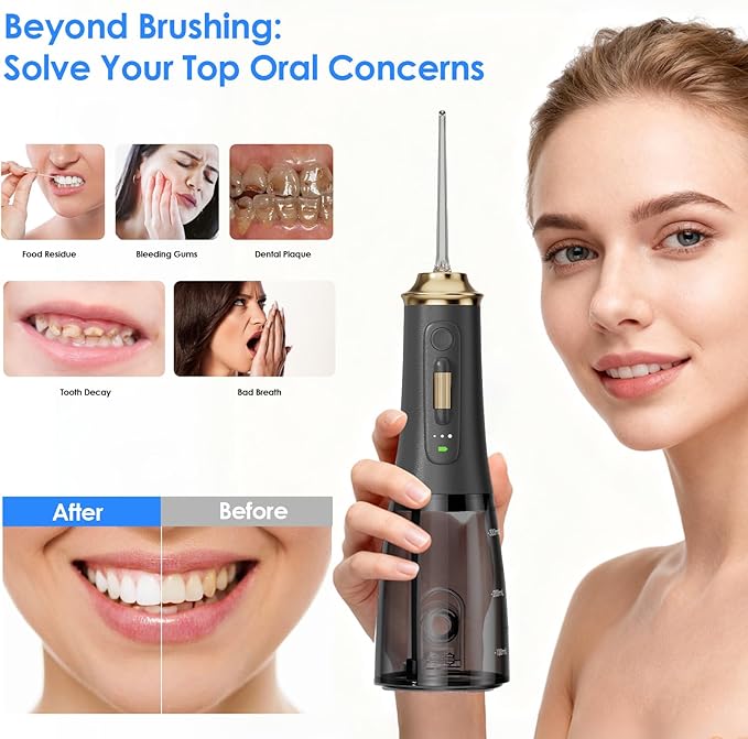 300ML Long-Lasting Battery Life Water Flosser Adjustable Pressure Oral Irrigator Flosser with 4 Interchangeable Nozzle Tips for Implants/Braces/Receding Gums (Black&ampGold)