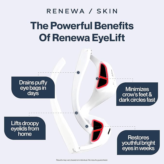 Renewa EyeLift | Under-Eye Beauty Tool with Gentle Light | Skincare Tool for Refreshing Brightening and Radiant-Looking Skin | At-Home Self-Care Facial Tool for Smoother-Looking Eyes