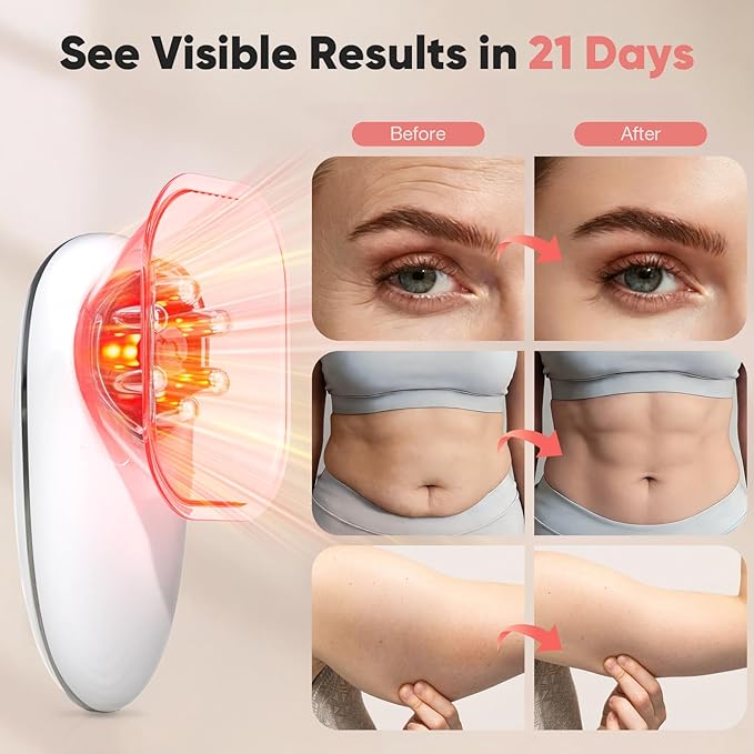 3-in-1 Electric Cellulite Massager 3-in-1 Body Sculpting Machine for Stomach Waist Arms Legs Handheld Adjustable Cellulite Massage Tool Skin Tightening Tool for Women and Men White