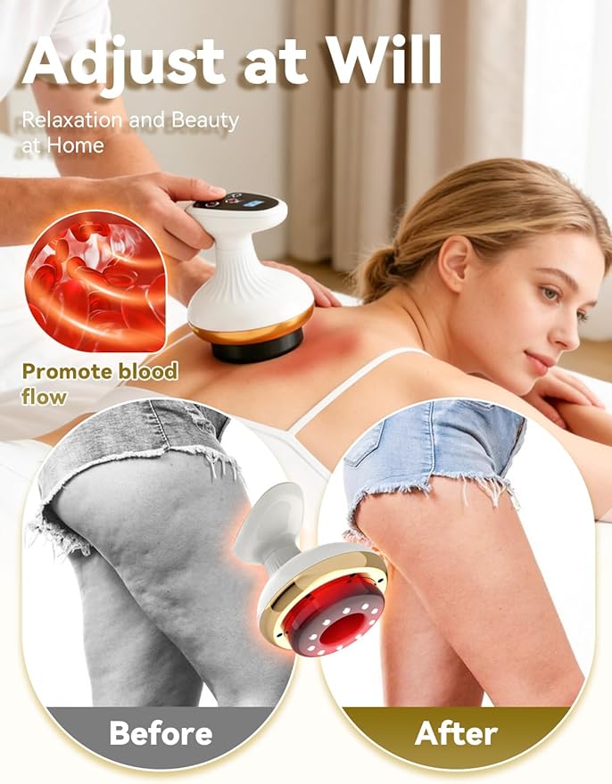 Cellulite Remover Firmer More Toned Skin Deep Massage Natural Skin Firmness 9 Suction Levels &amp Heat Rechargeable Helps Reduce Stretch Marks &amp Cellulite for Legs Arms &amp Belly (Advanc