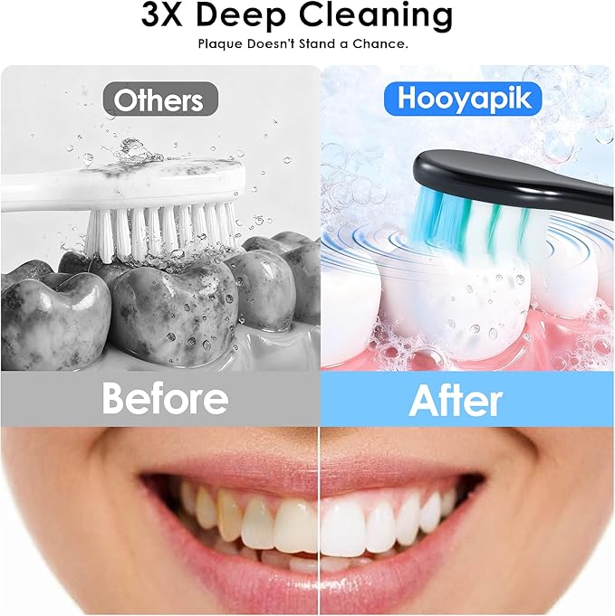 38000 VPM Sonic Electric Toothbrush Set with 6 Brush Heads-2 Minute Timer-4 Cleaning SettingsIPX7 WaterproofLightweight and USB Rechargeable Toothbrush for Oral Care (E0010-Black)