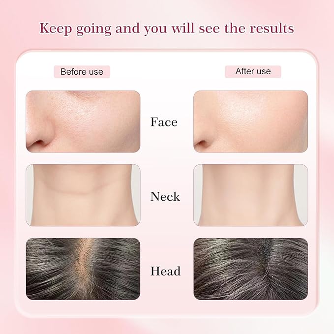 Red-Light-Therapy-for-Face and Neck-Eye-Head Massager7 Colors Skin Rejuvenation Lifting Facial Massager for ToningGlow BoostWrinkle for BirthdayChristmasMothers DayValentines Day Gifts (Pink)