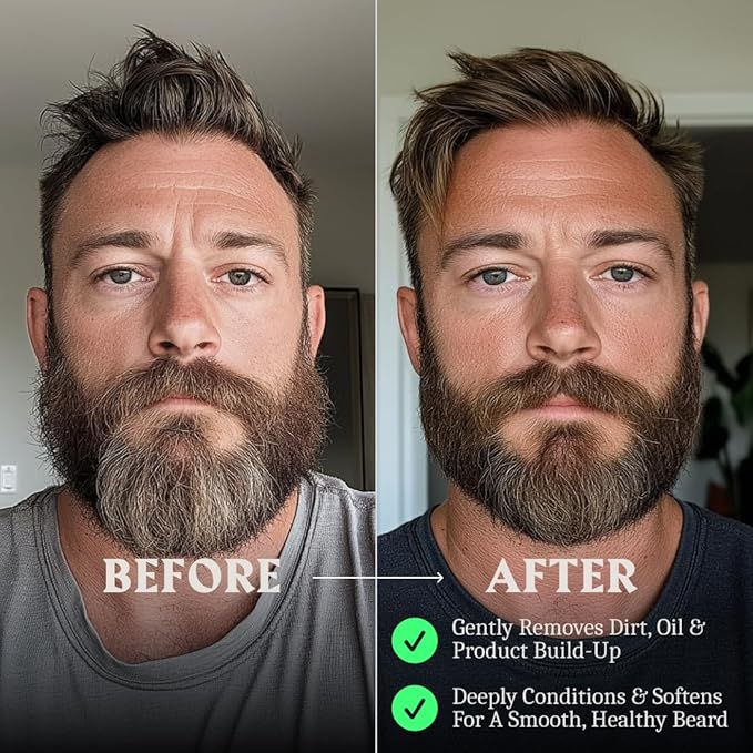 Striking Viking Unscented Beard Wash &amp Conditioner - 10 Fl Oz Pack of 2 - Deep Cleansing Oil Formula - Soothing Softener with Jojoba Oil - Itch-Free Gentle Hydration for Beard Care