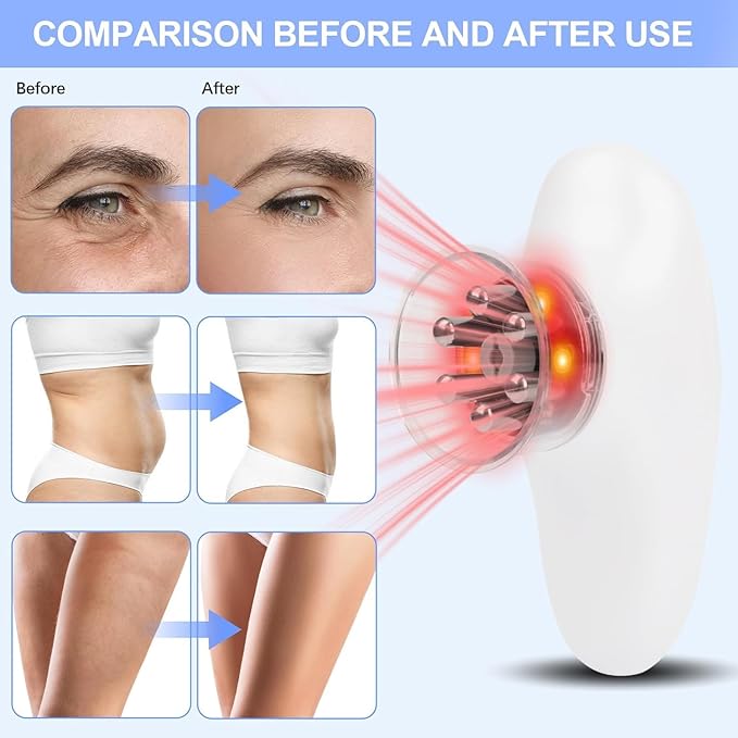5-in-1 Body Sculpting Machine for Home Lymphatic Drainage Massager Anti Cellulite Massage Tool Skin Tightening Device for Abdomen Legs Arms Face Cupping Machine with Red Light Therapy