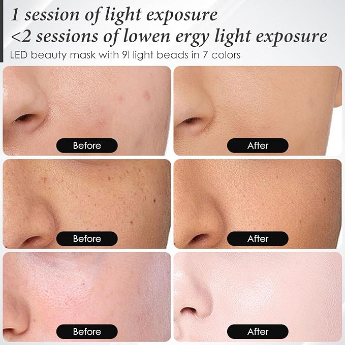 Red Light Mask for Face 7-1 Colors Facial Care Mask 850nm Infrared &amp Red Light Masks Ergonomic Design for Home &amp Travel White
