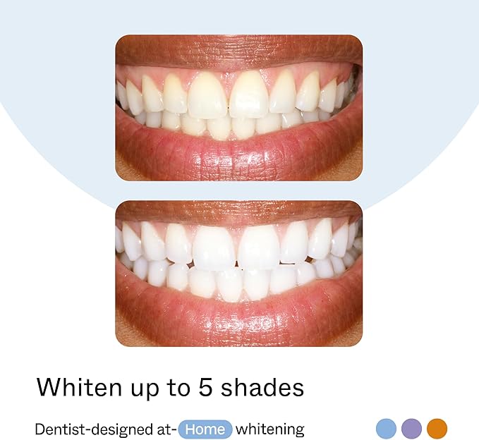 Opalescence GO Home Advanced Teeth Whitening Trays 15% (10 Treatments) Hydrogen Peroxide PF Whitening Prefilled Kit - Developed by Leaders in Professional Whitening 5822-T