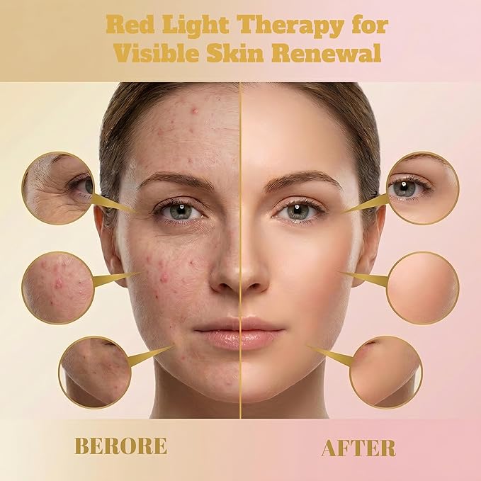 Red Light Therapy Mask for Face LED Face Mask Light Therapy with 7 Colors &amp Infrared Facial Skincare Device with Remote 10–30 Min Timer Silicone Mask for Radiant-Looking Skin at Home