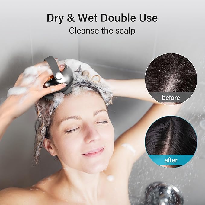 arboleaf Scalp Massager Rechargeable Head Massager Scalp Stress Relax Waterproof Handheld Hair Scratcher with 8 Removable Massage Claws Gift for Dad Mom