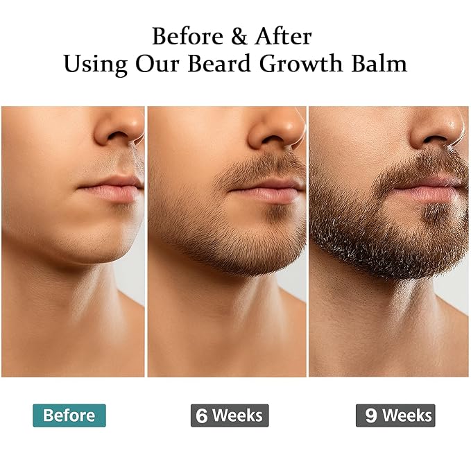 Estimulante Para Barba – Bálsamo de Crecimiento Ultra Potente Beard Stimulating Balm Moisturizes &amp Strengthens Beard 100 ml / 3.5 oz
