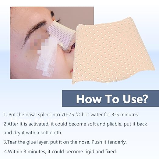 Thermoplastic Nasal Splints Nose External Support Protector for Nose Brace Fracture Rhinoplasty Septoplasty ENT Orthopedic Immobilization Corrugated Shape 5 PCS (L)