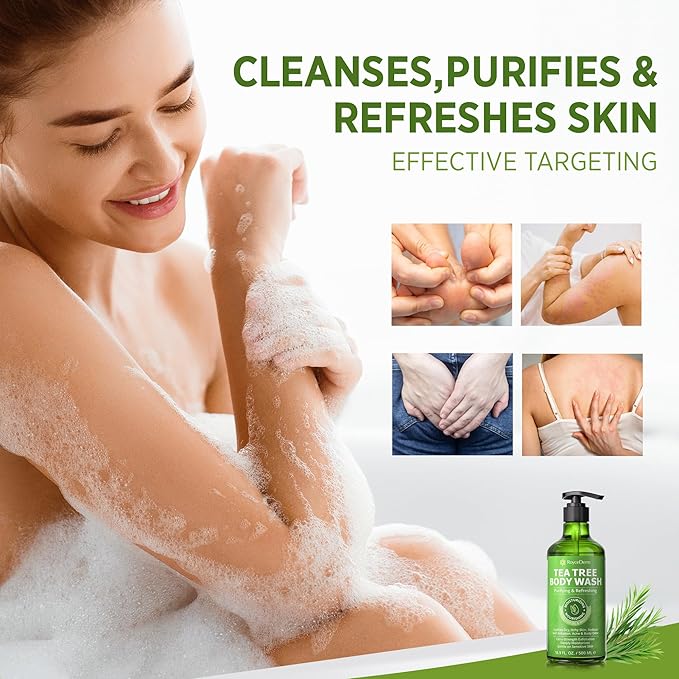 Roycederm Antifungal Body Wash &amp Soap Antibacterial Tinea Versicolor Tea Tree Body Wash Back Acne Folliculitis For Jock Itch Athletes Foot Body Odor Ringworm