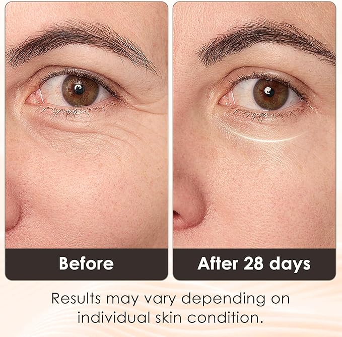JVV Red Light Therapy for Eyes 5 Modes Under-Eye Red Light Eye Mask Eye Massager for Fine Lines Eye Bags and Dark Circles for Men and Women