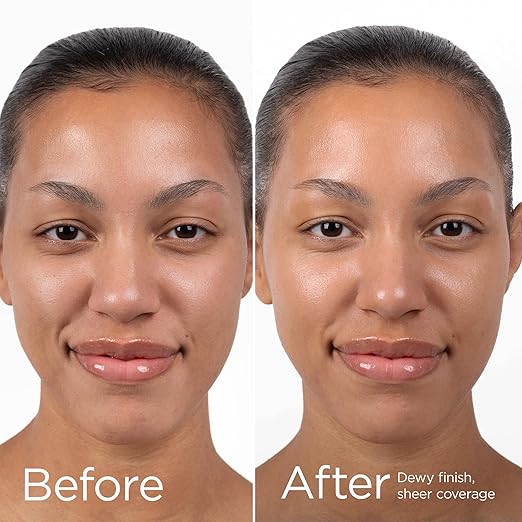 EltaMD UV Daily Face Sunscreen with Transparent Zinc Oxide and Hyaluronic Acid Moisturizes and Protects Great for Dry Combination and Normal Skin