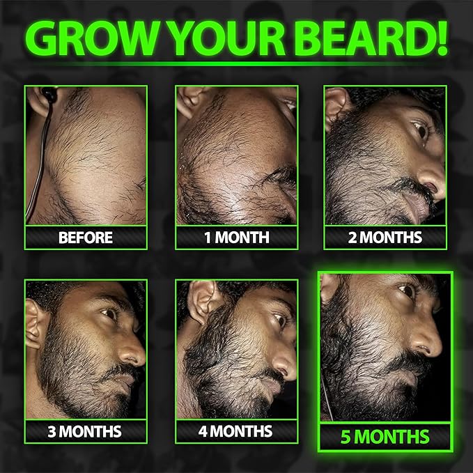 Beard Growth Kit w/GROW XXL Beard Serum for Maximum Facial Hair &amp Conditioner + GROW 11-in-1 Mens Shampoo &amp Conditioner (Hair Growth Shampoo for Men w/Biotin) - Formulated in America