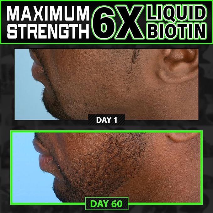 Beard Growth Kit w/ 2X Thickening Biotin Beard Balm &amp Conditioner + 6X Liquid Biotin w/ Collagen Peptides for Men's Beard &amp Hair Growth