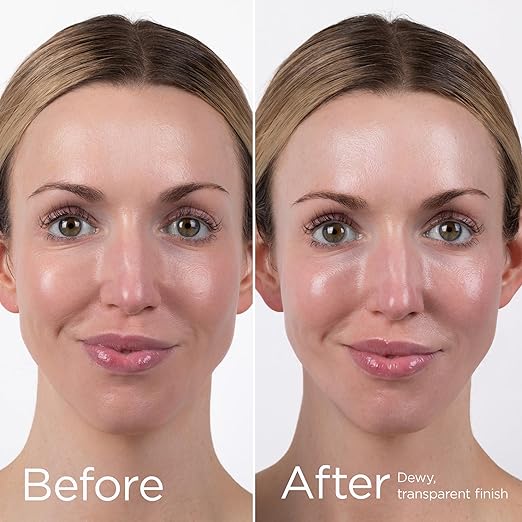 EltaMD UV Daily Face Sunscreen with Transparent Zinc Oxide and Hyaluronic Acid Moisturizes and Protects Great for Dry Combination and Normal Skin