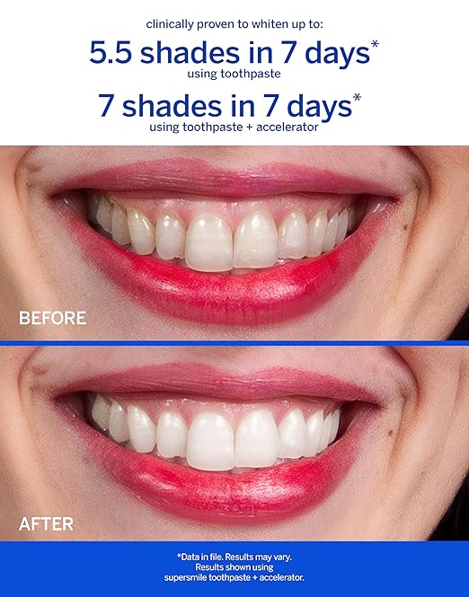 Supersmile Fluoride-Free Whitening System – 8 oz Professional Grade Whitening Toothpaste &amp Accelerator – Whitens up to 6 Shades &amp Strengthens Enamel