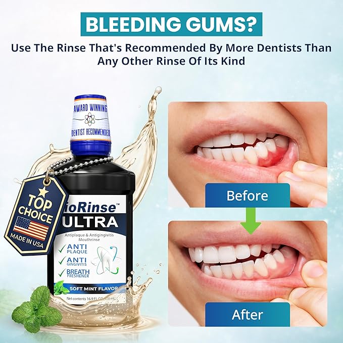 ioRinse Ultra: The Most Dentist-Recommended Periodontal Rinse &amp Gum Mouthwash of its Kind. Fights Gingivitis Bleeding Gums Dental Plaque &amp Bad Breath. With Molecular Iodine &amp Xylitol. No