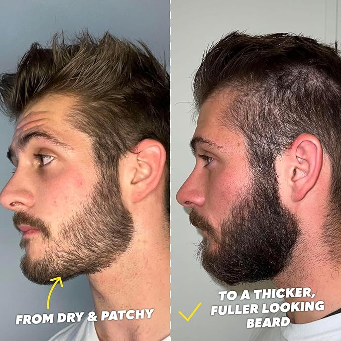 The Beard Club Ultimate Beard Growth Kit - Derma Roller Growth Oil Vitamins Vitamin Spray Biotin Balm Conditioner Cream Balms Shampoo Razor Scissors Combs Brush Cleansing Spray - Gift Set