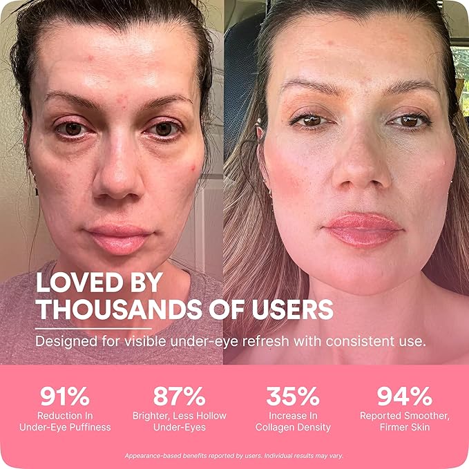 BOTANIQUE PARIS® RevitalEyes Under Eye Red Light Therapy [SUITABLE FOR ALL SKIN TYPES] - Light Therapy Device for Under Eye Bags Puffiness &amp Fine Lines - Skincare Tool for Women &amp Men (Bright