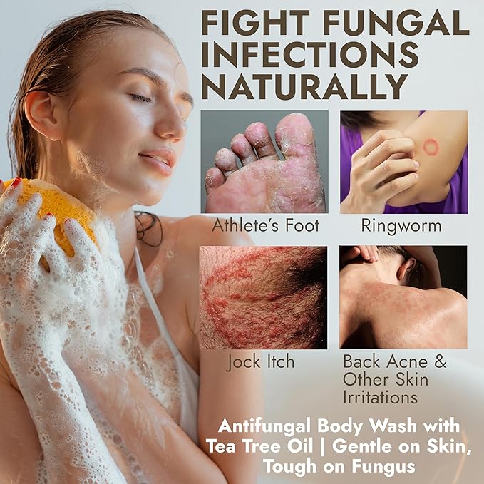 Antifungal Body Wash with Tea Tree Oil | Antifungal Soap for Back AcneTreats Ringworm Eczema &amp Jock Itch | Antifungal Body Soap For Men And Women | Includes Silicon Scrubber (16.9 oz)