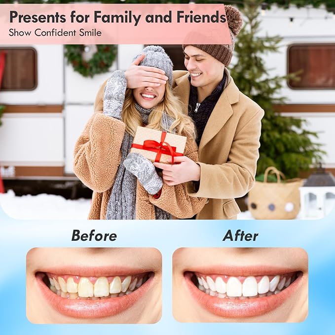 Tooth Polisher Rechargeable Teeth Polisher for Daily Cleaning Whitening and Polishing Electric Dental Teeth Polishing with LED Light 5 Brush Heads 5 Speed Modes Waterproof