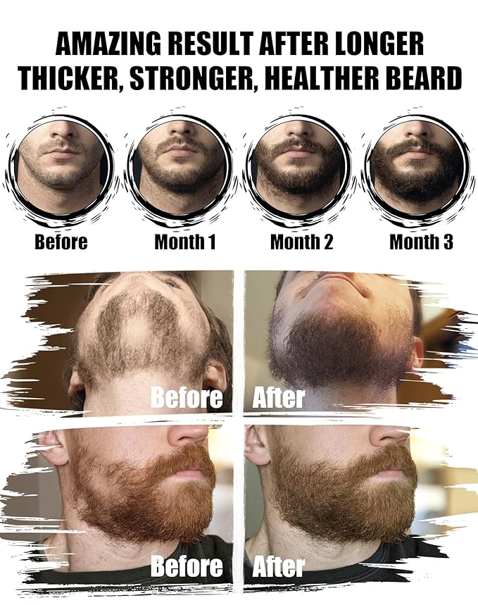 Beard Kit for Men Grooming &amp Care: with 2 Pack Beard Oils and Balm - Wash &amp Conditioner for After Shave Lotions Sandalwood Brush and Comb Sets with Scissors Valentines Fathers Gifts for Dad/