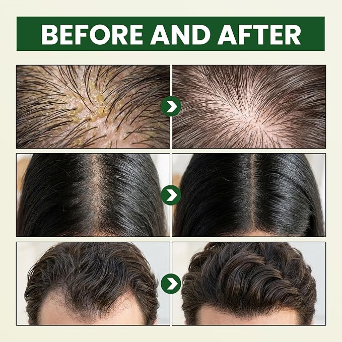 ABERA Folliculitis Body Wash and Grapefruit Hair Regrowth Shampoo
