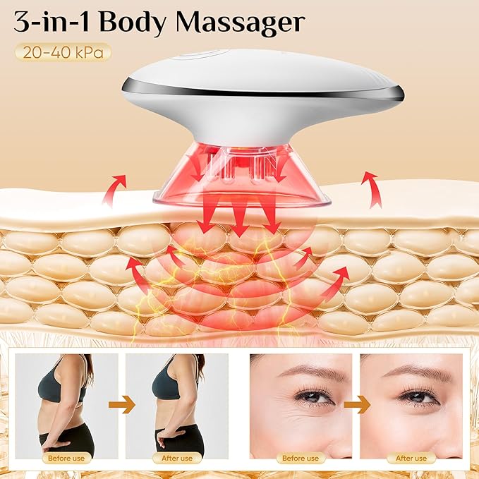 Body Smart Scraping - 3 in 1 Body Sculpting Machine - Best Cellulite Removal Machine- Body SculptorSuitable for Legs Abdomen Arms Love Handles Relieves Muscle Tension and Tightens Skin